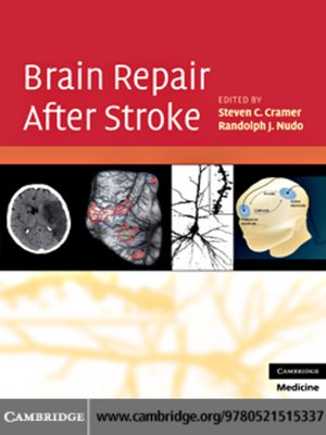 cover image of Brain Repair After Stroke